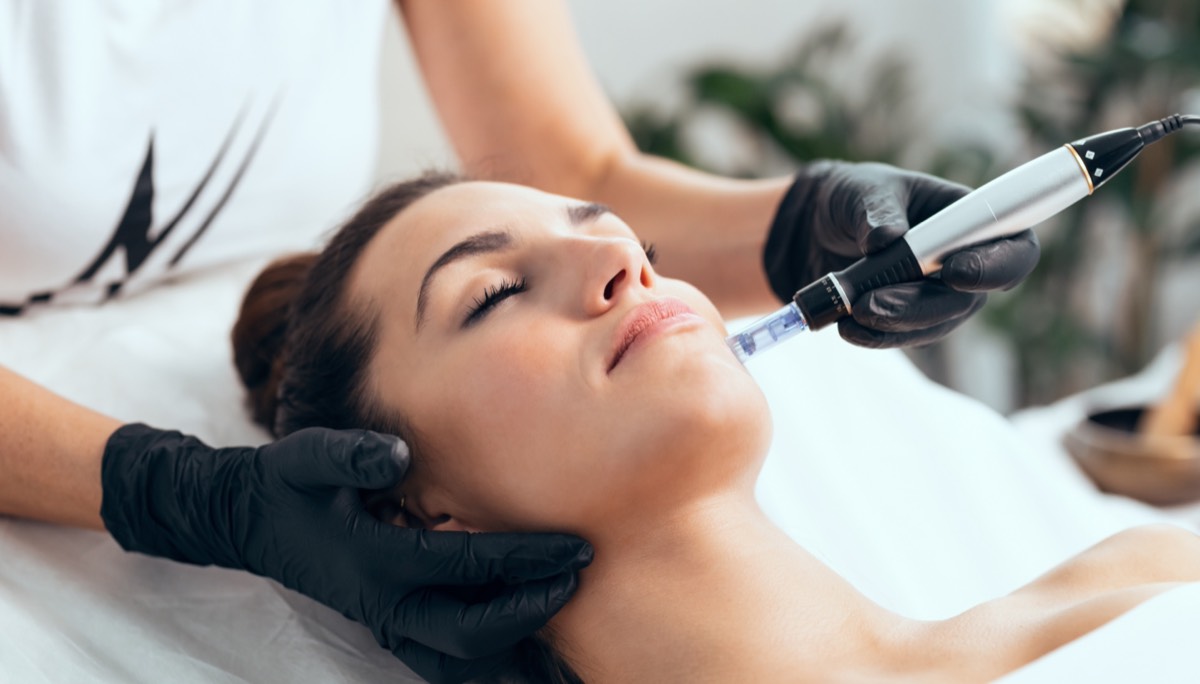 Microneedling